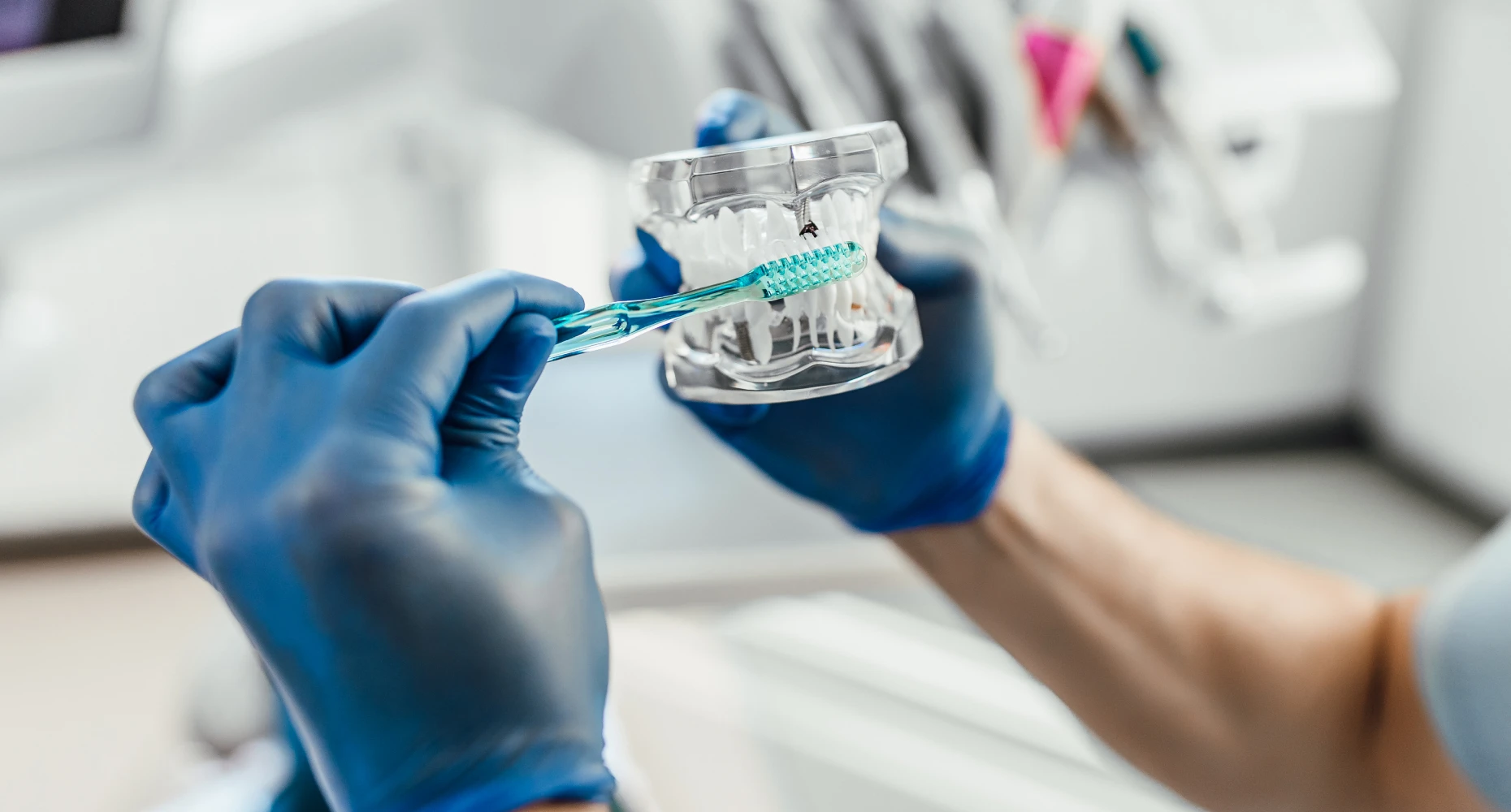 hygiène avec les gouttieres invisibles au Cabinet d'Orthodontie La Trinité Sourire, du Dr Browarski