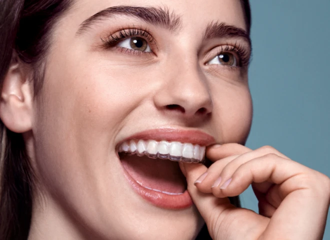 gouttieres au Cabinet d'Orthodontie La Trinité Sourire, du Dr Browarski