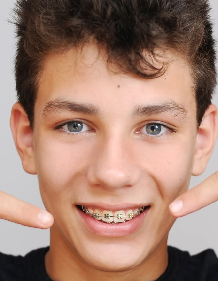 orthodontie adolescents au Cabinet d'Orthodontie La Trinité Sourire, du Dr Browarski
